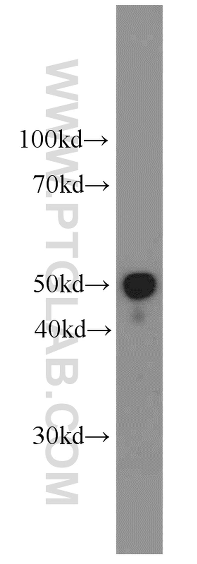 Apolipoprotein H Antibody in Western Blot (WB)