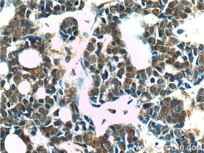 PMS2 Antibody in Immunohistochemistry (Paraffin) (IHC (P))