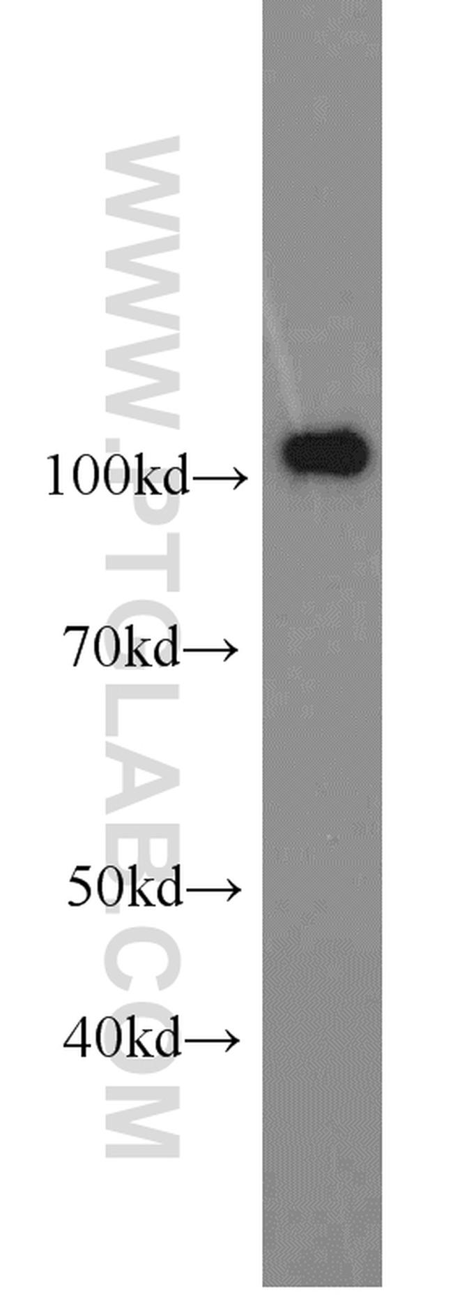 PMS2 Antibody in Western Blot (WB)