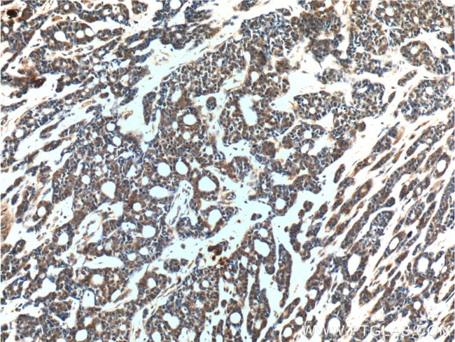 PMS2 Antibody in Immunohistochemistry (Paraffin) (IHC (P))