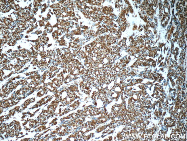 PMS2 Antibody in Immunohistochemistry (Paraffin) (IHC (P))