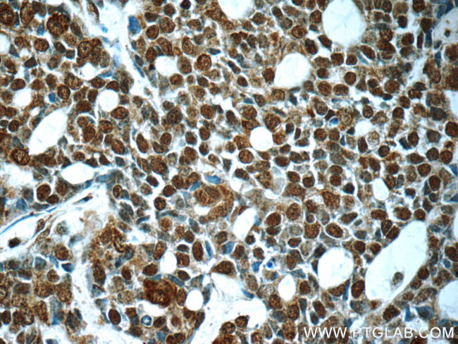 PMS2 Antibody in Immunohistochemistry (Paraffin) (IHC (P))