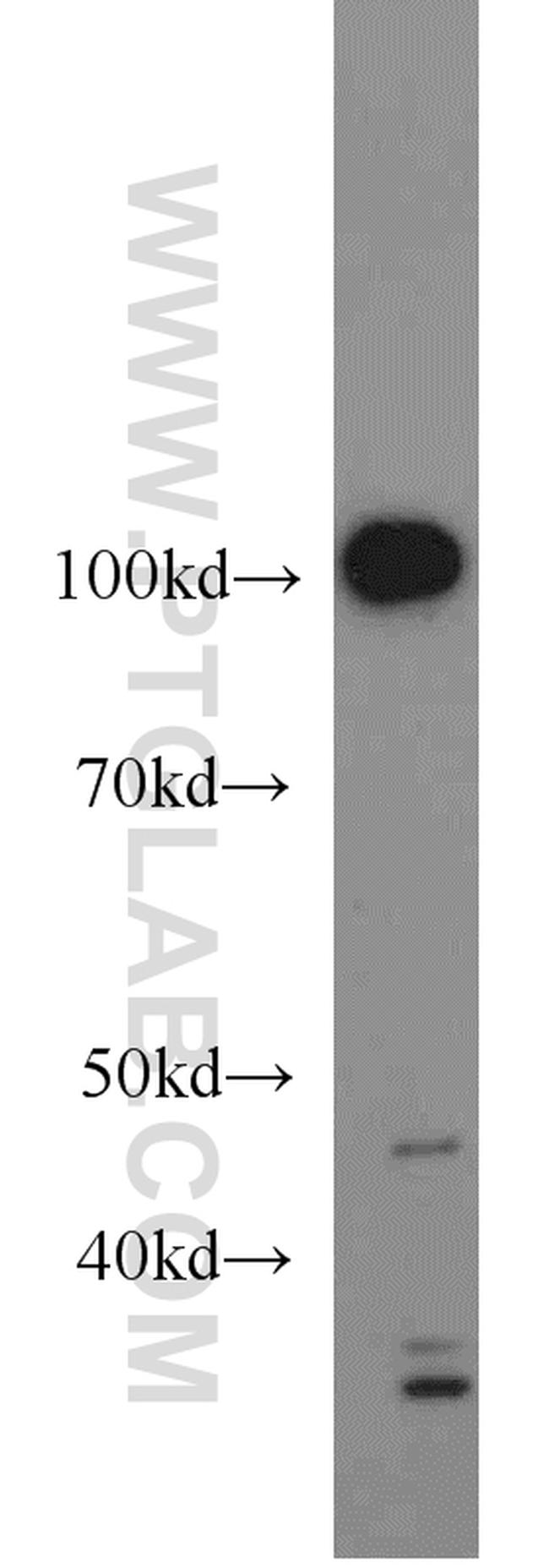 PMS2 Antibody in Western Blot (WB)