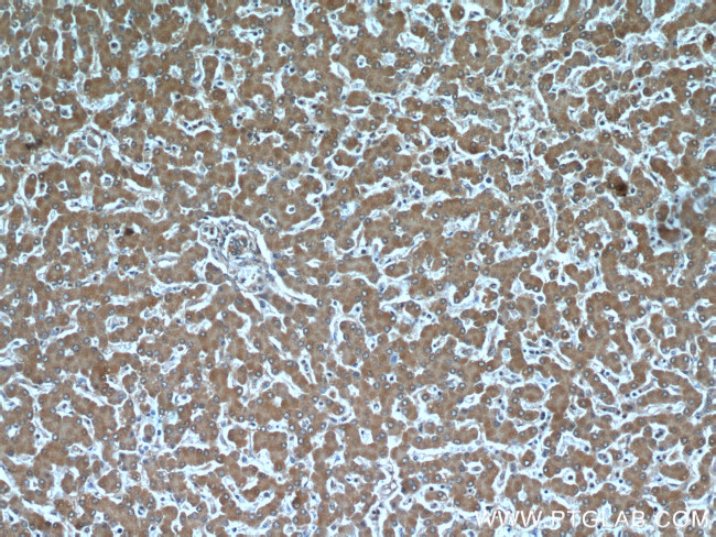 TTL Antibody in Immunohistochemistry (Paraffin) (IHC (P))