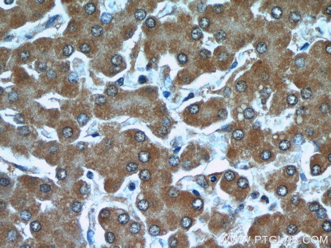 TTL Antibody in Immunohistochemistry (Paraffin) (IHC (P))