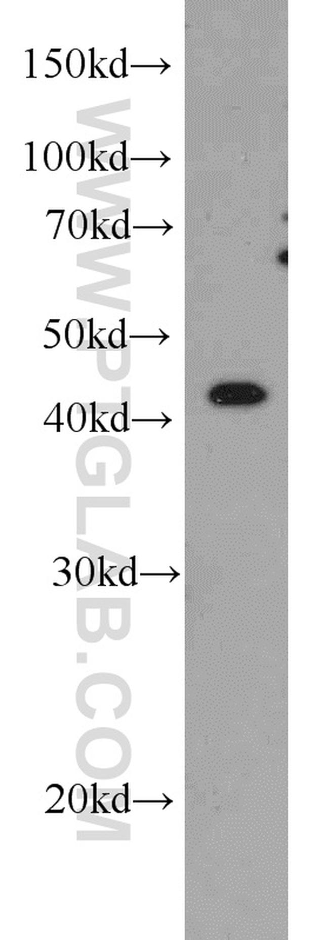 TTL Antibody in Western Blot (WB)