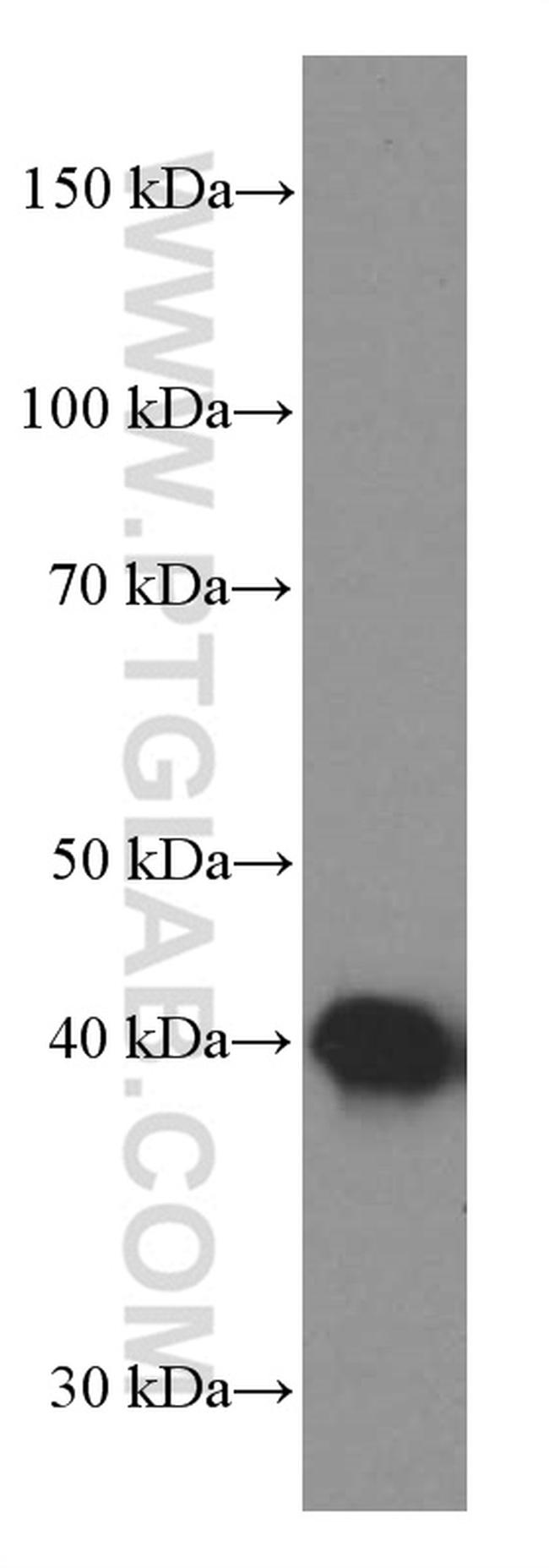 TTL Antibody in Western Blot (WB)