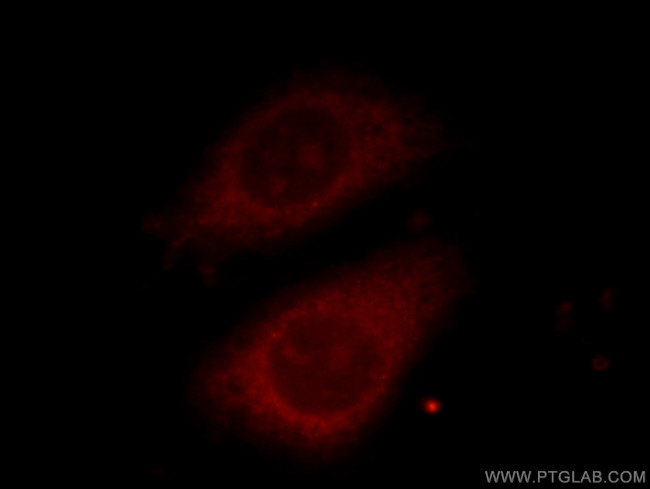 TELO2 Antibody in Immunocytochemistry (ICC/IF)