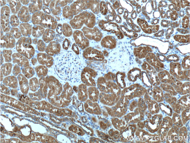 TELO2 Antibody in Immunohistochemistry (Paraffin) (IHC (P))