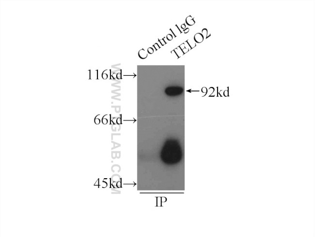 TELO2 Antibody in Immunoprecipitation (IP)