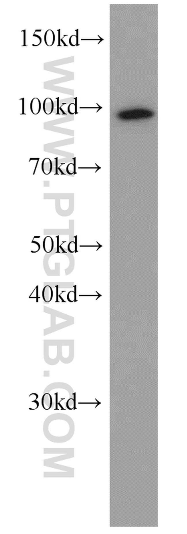 TELO2 Antibody in Western Blot (WB)