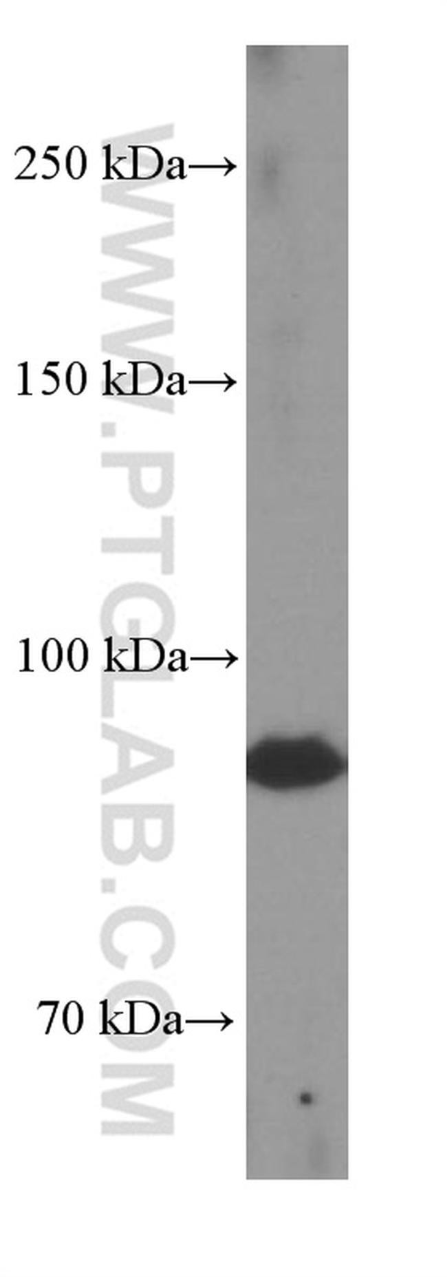 TELO2 Antibody in Western Blot (WB)