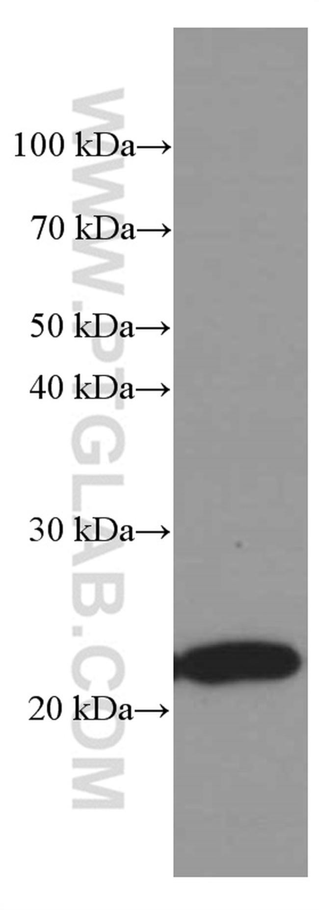 Phospho-TDP43 (Ser403, Ser404) Antibody in Western Blot (WB)