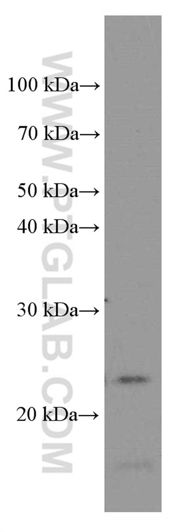 Phospho-TDP43 (Ser403, Ser404) Antibody in Western Blot (WB)