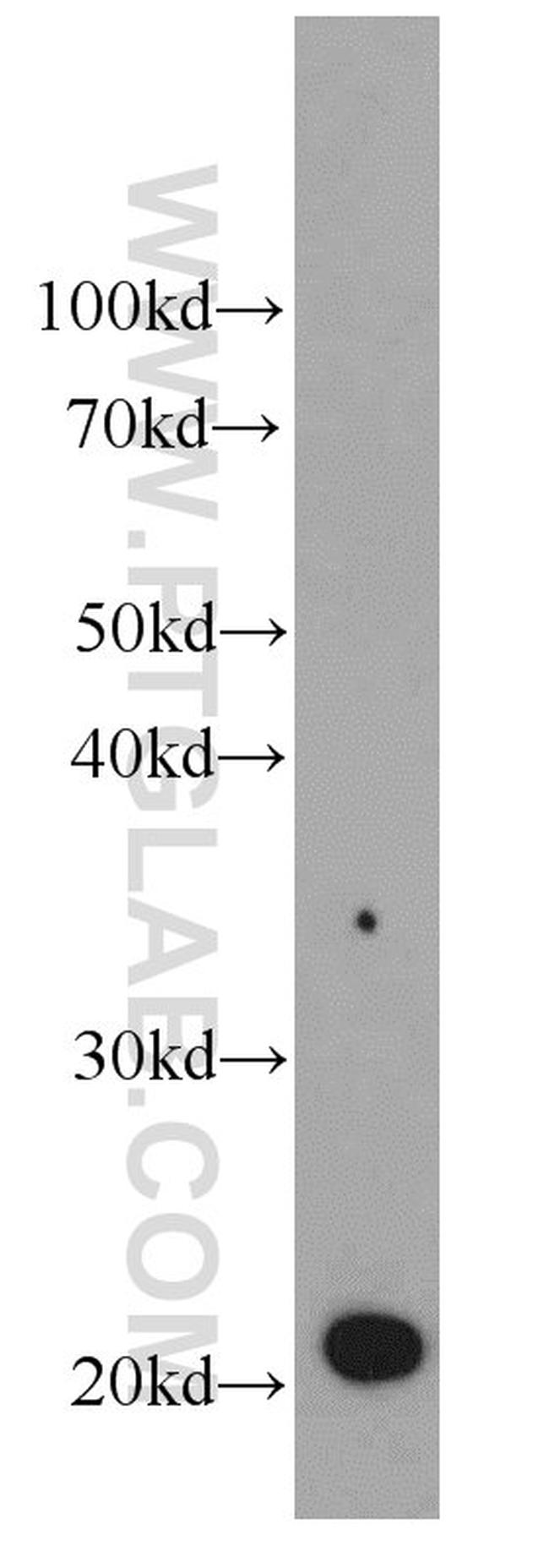 GM2A Antibody in Western Blot (WB)