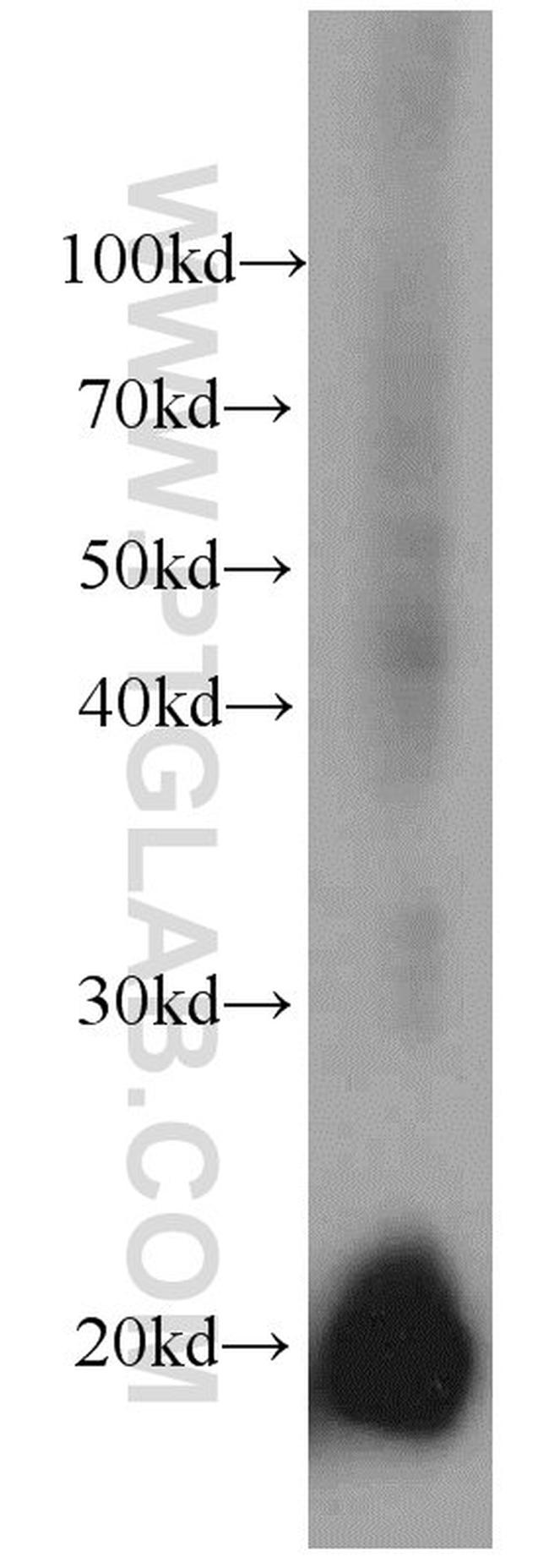 GM2A Antibody in Western Blot (WB)