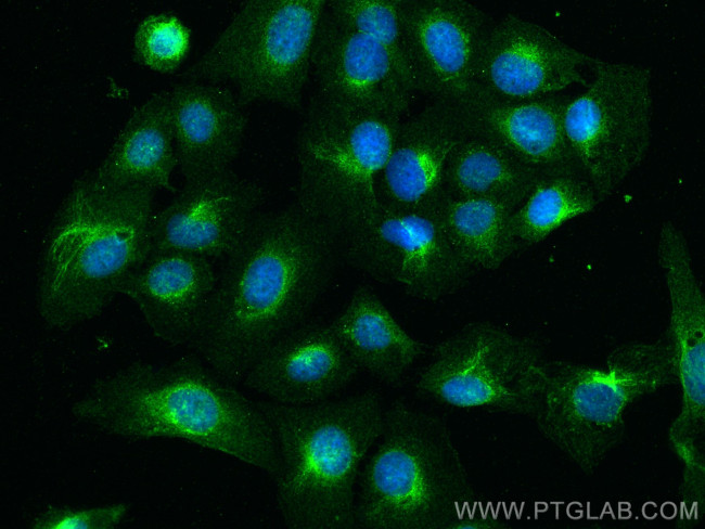 IFITM2/3 Antibody in Immunocytochemistry (ICC/IF)