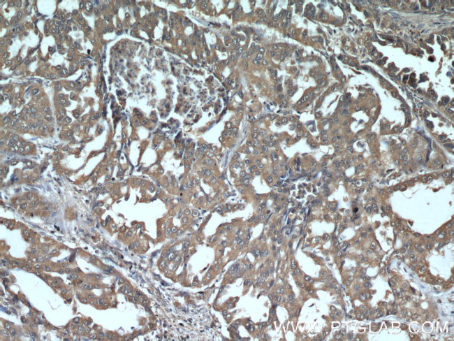 IFITM2/3 Antibody in Immunohistochemistry (Paraffin) (IHC (P))