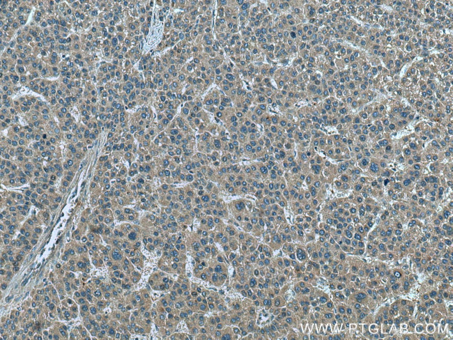 IFITM2/3 Antibody in Immunohistochemistry (Paraffin) (IHC (P))