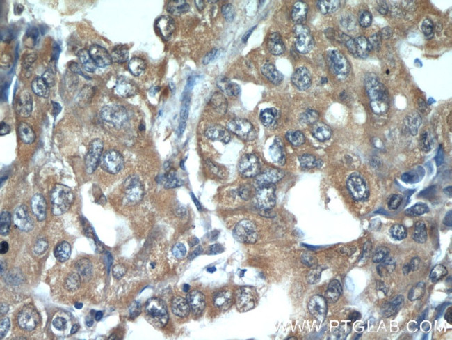 IFITM2/3 Antibody in Immunohistochemistry (Paraffin) (IHC (P))