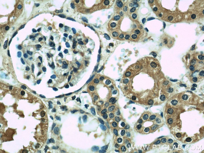 CISD2 Antibody in Immunohistochemistry (Paraffin) (IHC (P))