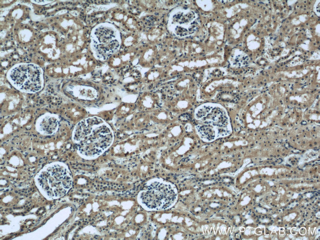 Serum amyloid P component Antibody in Immunohistochemistry (Paraffin) (IHC (P))