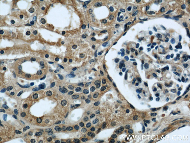 Serum amyloid P component Antibody in Immunohistochemistry (Paraffin) (IHC (P))