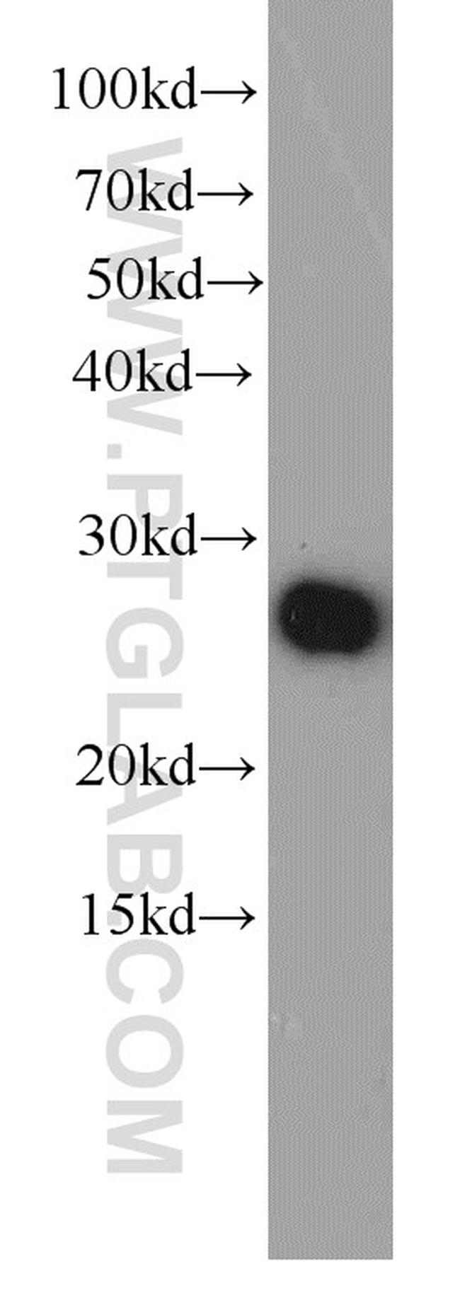 Serum amyloid P component Antibody in Western Blot (WB)