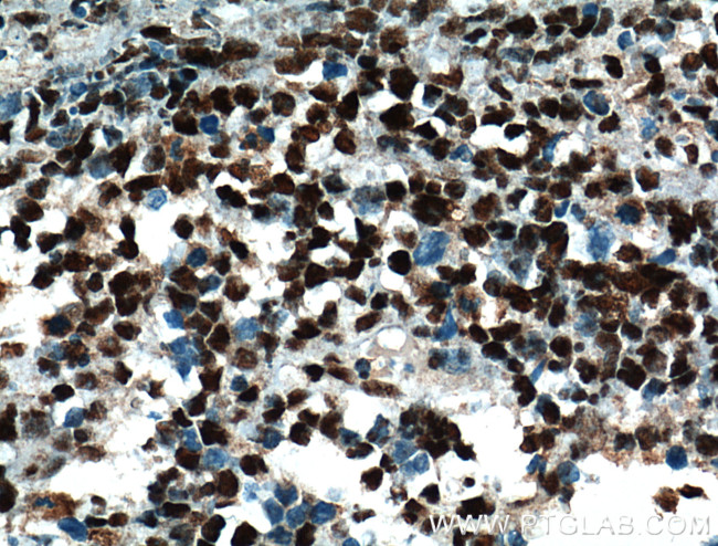 HDAC1 Antibody in Immunohistochemistry (Paraffin) (IHC (P))