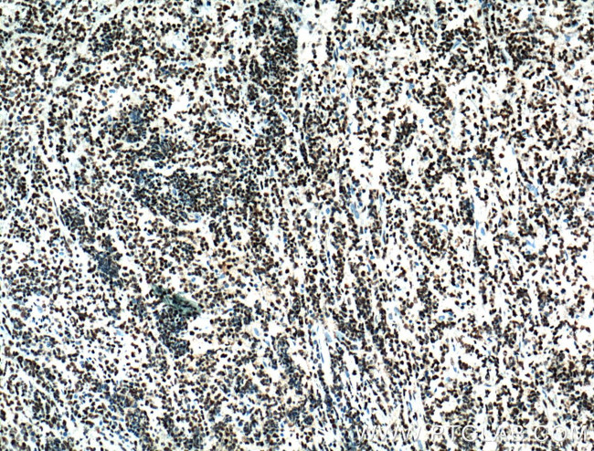 HDAC1 Antibody in Immunohistochemistry (Paraffin) (IHC (P))