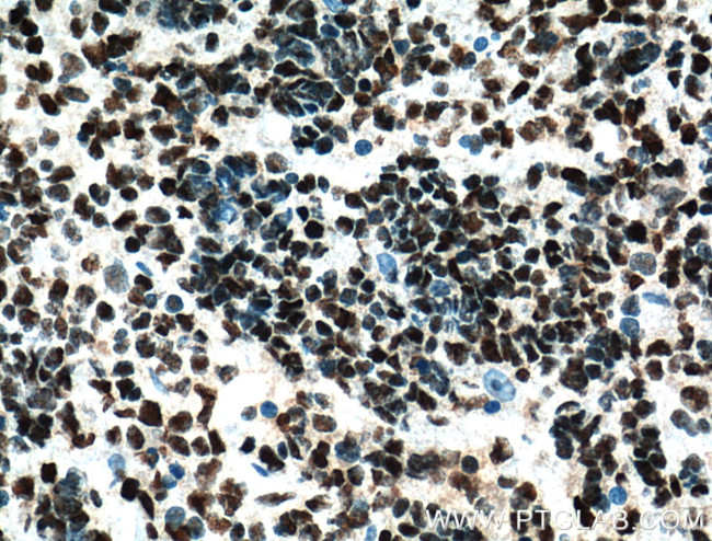 HDAC1 Antibody in Immunohistochemistry (Paraffin) (IHC (P))