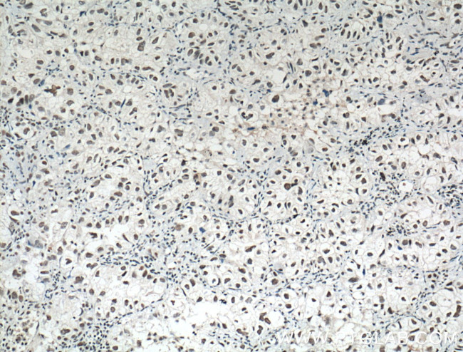 HDAC1 Antibody in Immunohistochemistry (Paraffin) (IHC (P))