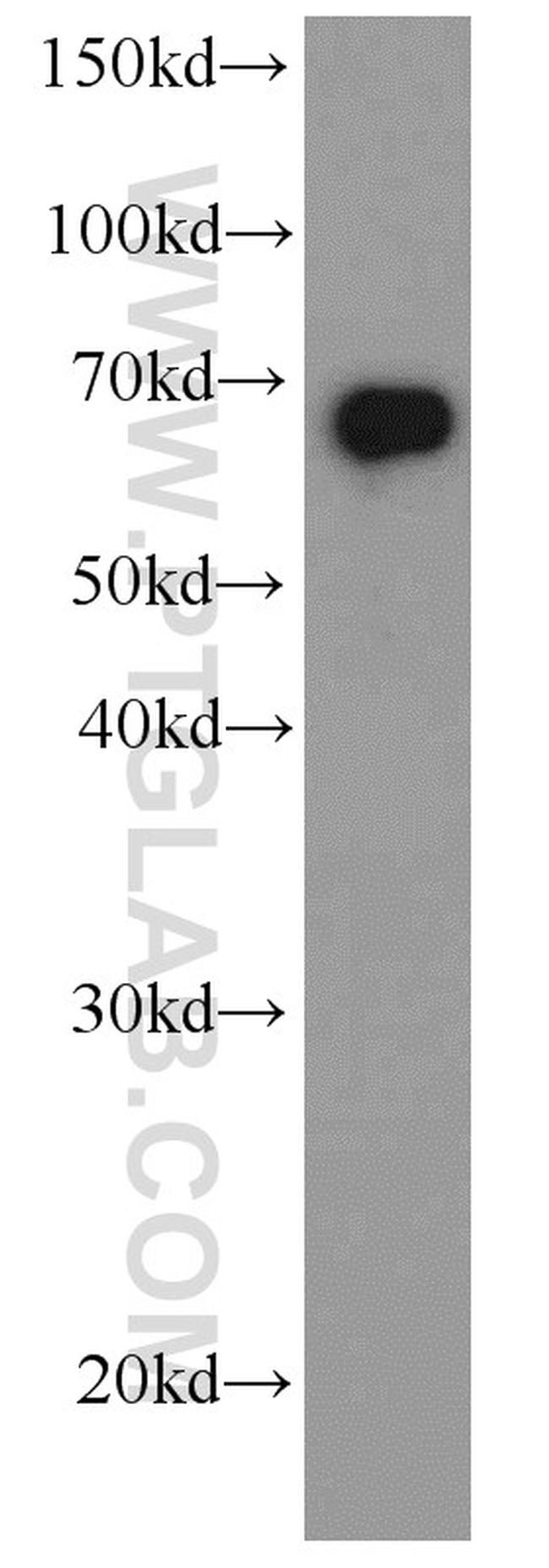 HDAC1 Antibody in Western Blot (WB)