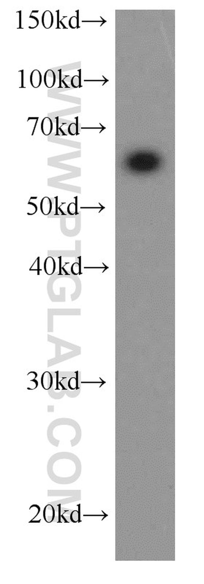 HDAC1 Antibody in Western Blot (WB)