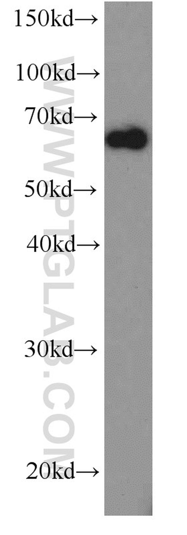 HDAC1 Antibody in Western Blot (WB)