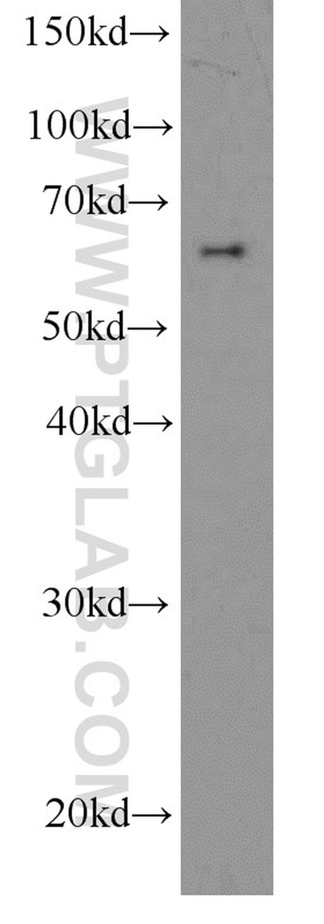 HDAC1 Antibody in Western Blot (WB)