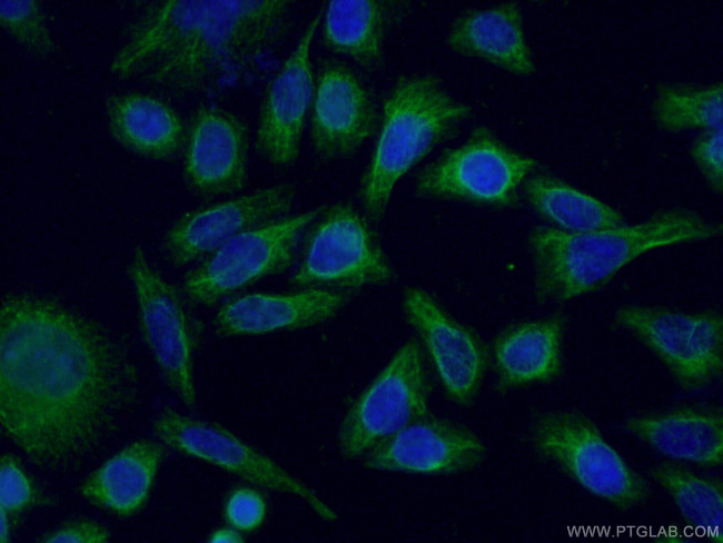 NCALD Antibody in Immunocytochemistry (ICC/IF)