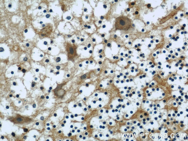 NCALD Antibody in Immunohistochemistry (Paraffin) (IHC (P))