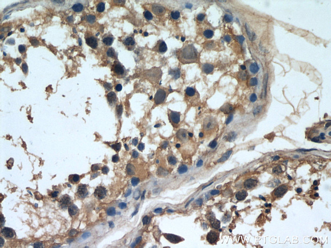 NCALD Antibody in Immunohistochemistry (Paraffin) (IHC (P))