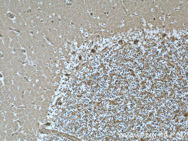 NCALD Antibody in Immunohistochemistry (Paraffin) (IHC (P))