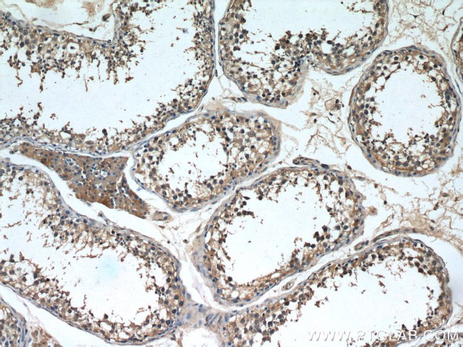 NCALD Antibody in Immunohistochemistry (Paraffin) (IHC (P))