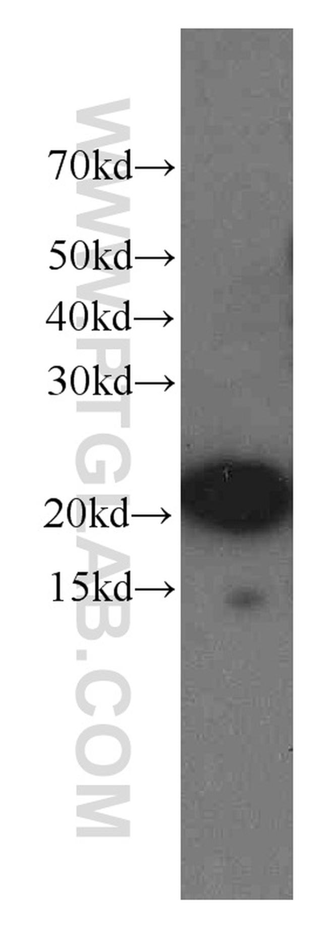 NCALD Antibody in Western Blot (WB)