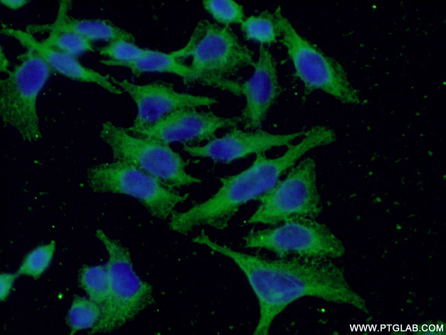 Factor XII Antibody in Immunocytochemistry (ICC/IF)