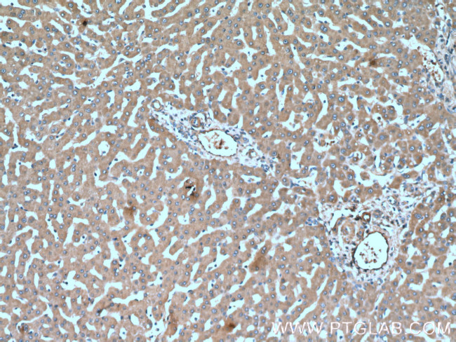 Factor XII Antibody in Immunohistochemistry (Paraffin) (IHC (P))