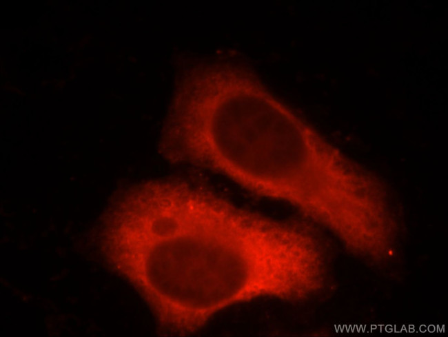 Factor XII Antibody in Immunocytochemistry (ICC/IF)