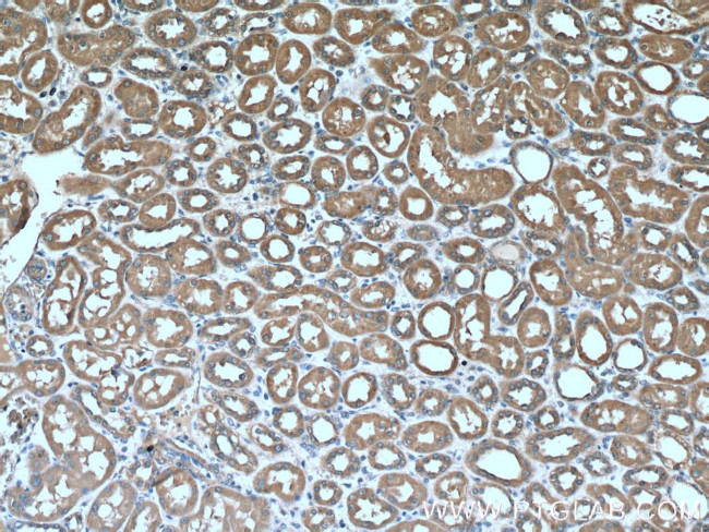 Factor XII Antibody in Immunohistochemistry (Paraffin) (IHC (P))