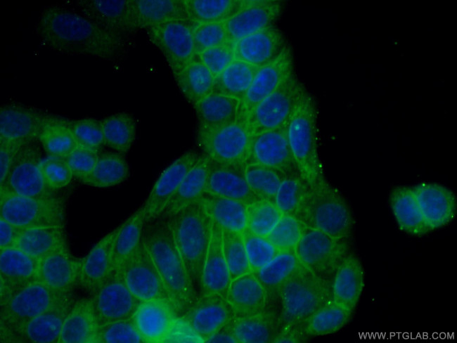 Caspase 8 Antibody in Immunocytochemistry (ICC/IF)