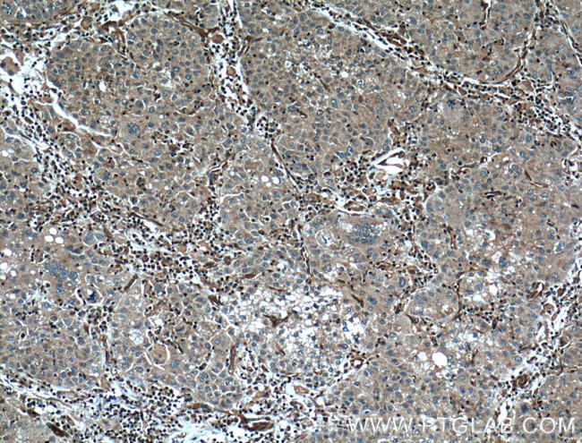 Caspase 8 Antibody in Immunohistochemistry (Paraffin) (IHC (P))