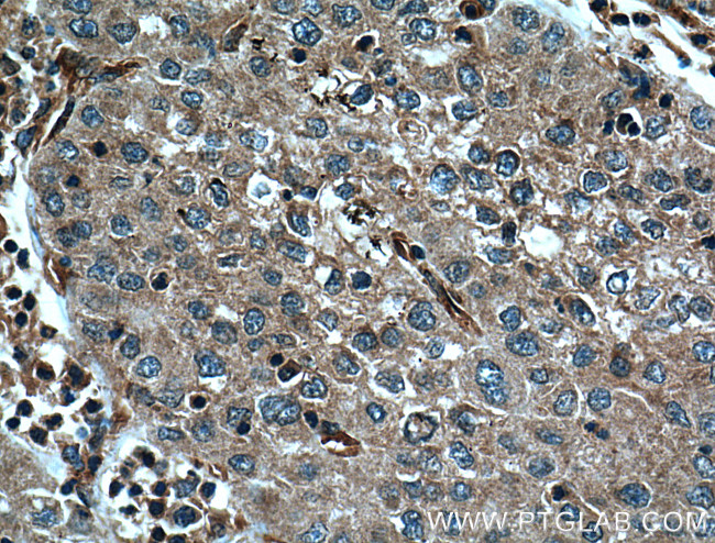 Caspase 8 Antibody in Immunohistochemistry (Paraffin) (IHC (P))