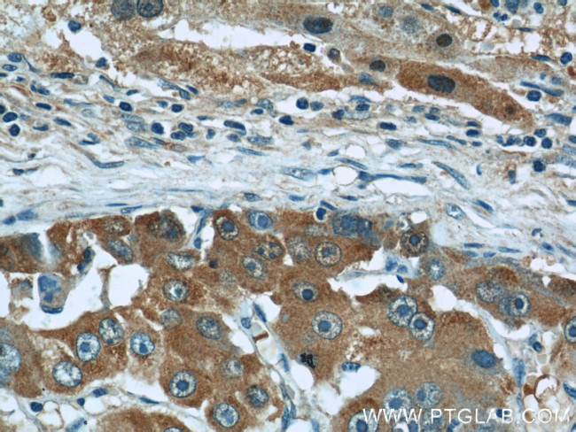 Fetuin-A Antibody in Immunohistochemistry (Paraffin) (IHC (P))